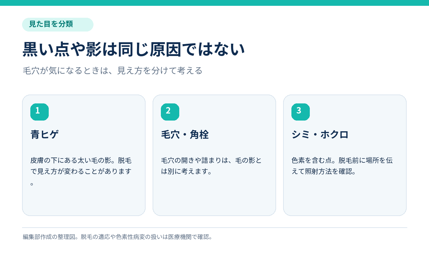 顔の黒い点を青ヒゲ、毛穴・角栓、シミ・ホクロに分けて考える図